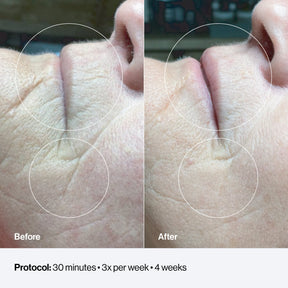 Celluma RESTORE