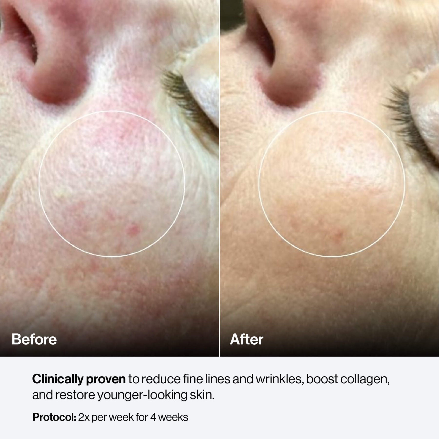 Celluma MYSTIQUE LED Mask