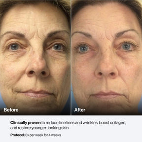 Celluma MYSTIQUE LED Mask