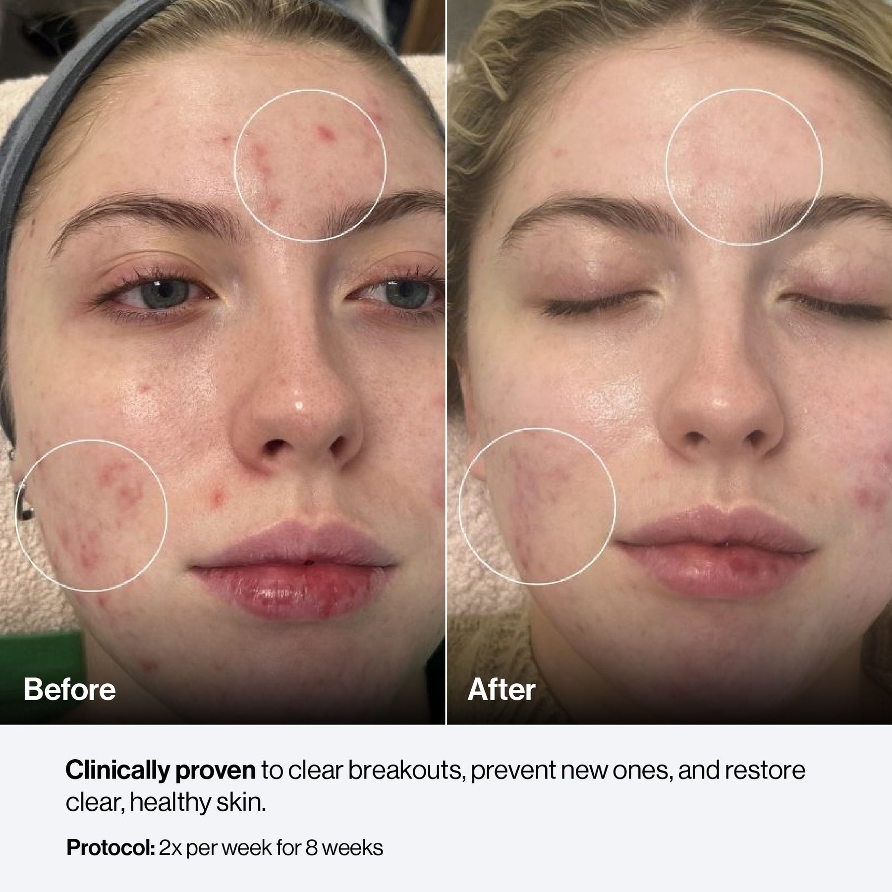 Celluma PRO PLUS