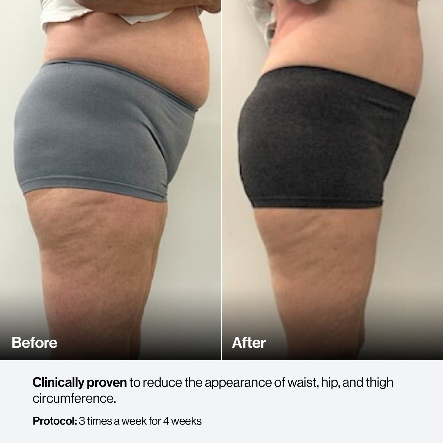 Celluma CONTOUR PLUS