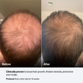 Celluma CONTOUR PLUS