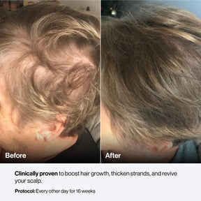 Celluma CONTOUR PLUS