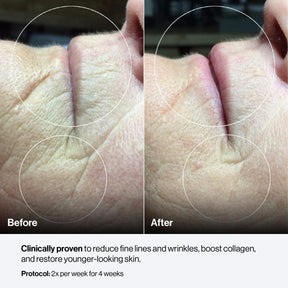 Celluma CONTOUR PLUS