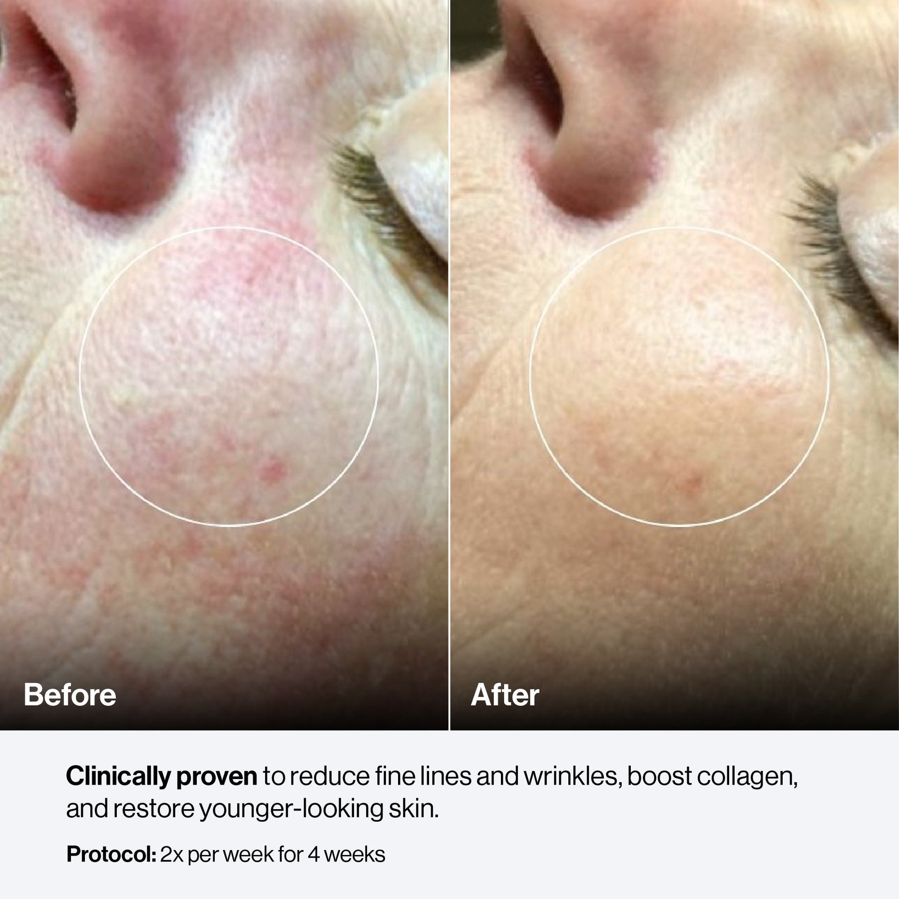 Celluma CONTOUR PLUS