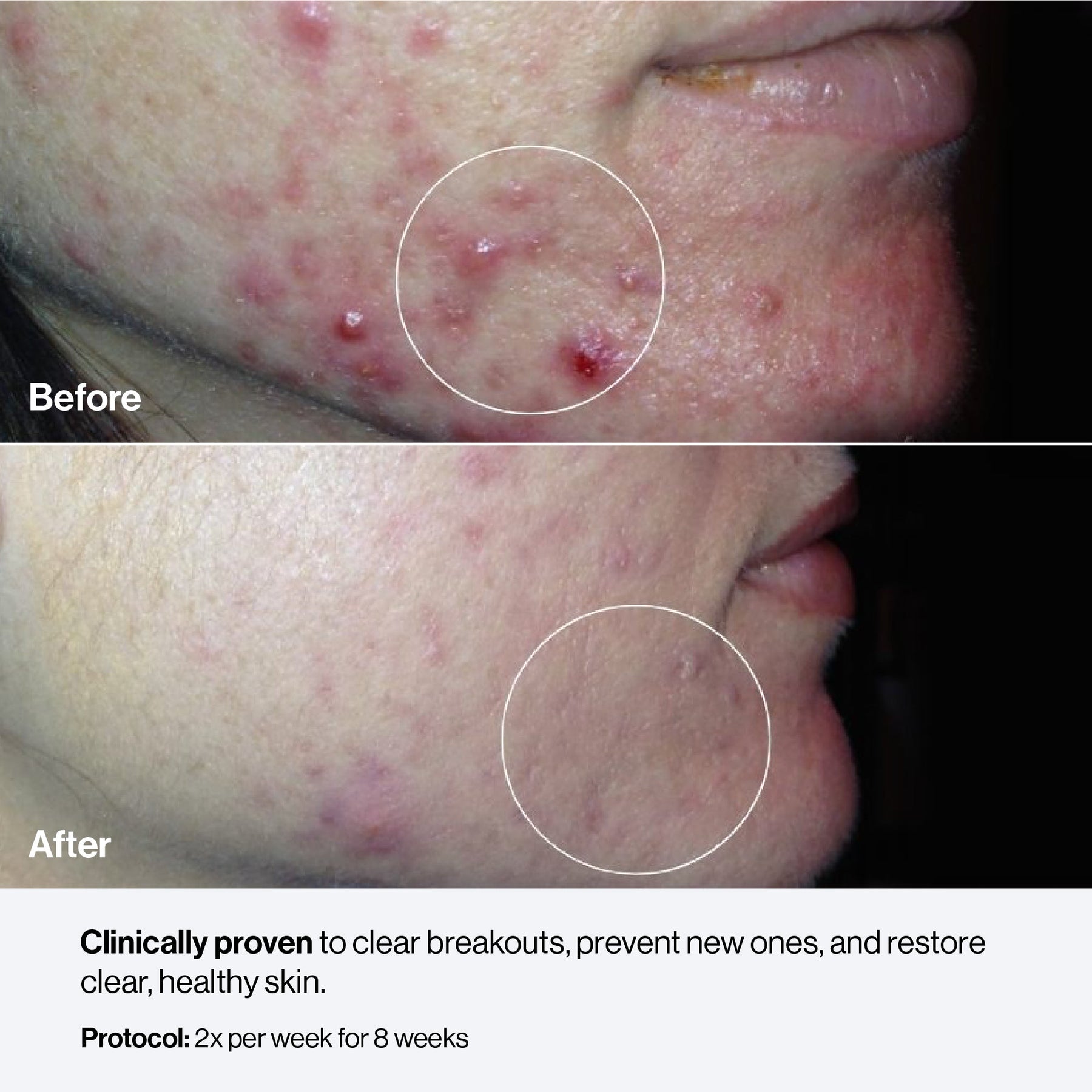 Celluma NOVA
