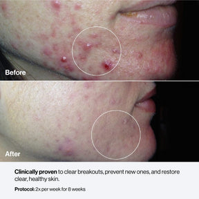 Celluma NOVA